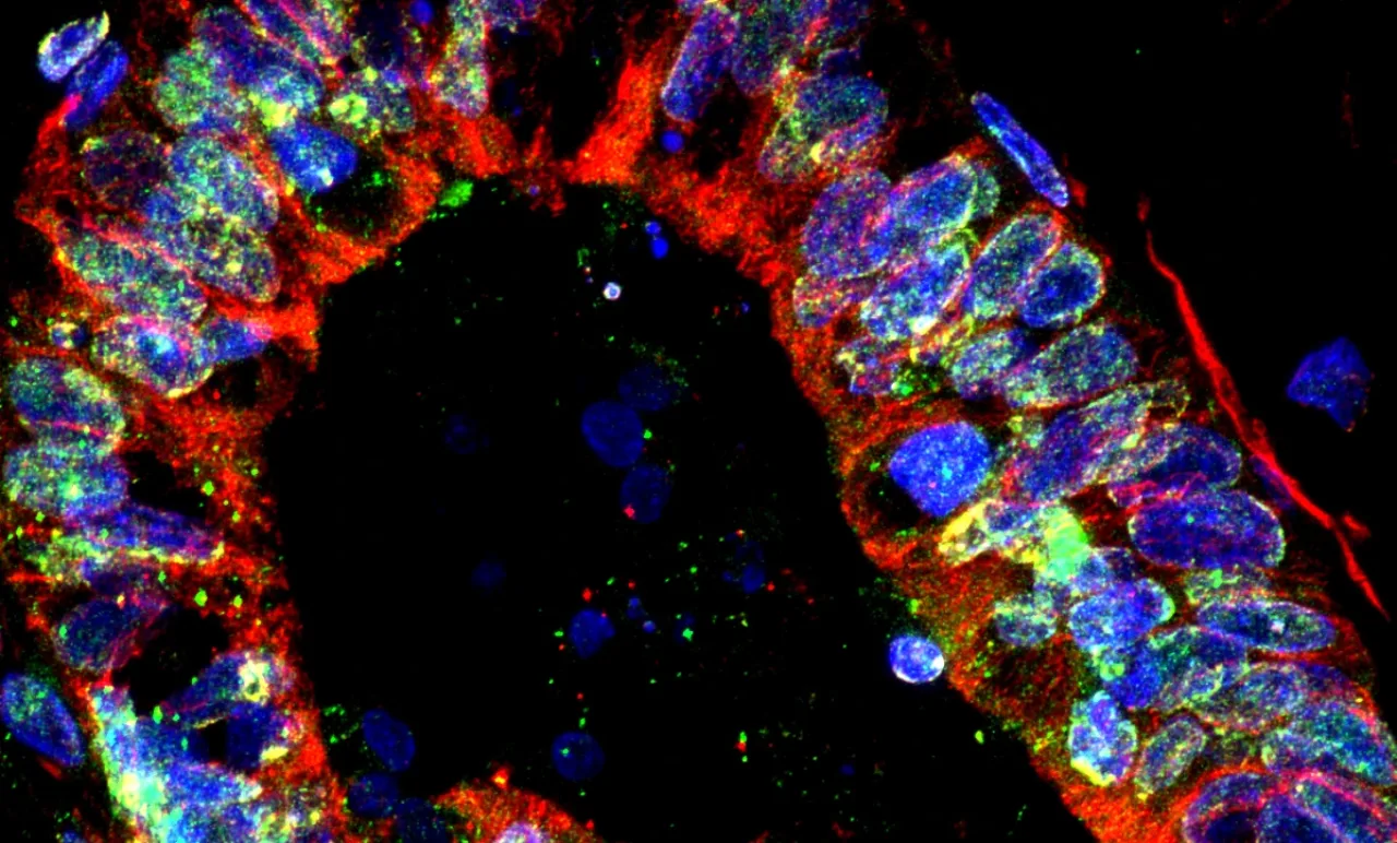 Inner Ear Organoid